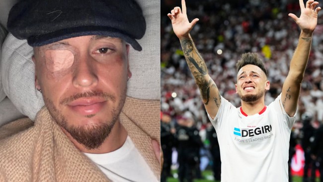 Monterreyn pelaaja Lucas Ocampos kärsii viruksen aiheuttamasta kasvohalvauksesta; fanit pitävät hauskaa meemeillä
