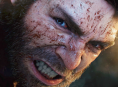 Marvelin Wolverine-n&auml;yttelij&auml; tutki raivotautisia koiria voidakseen esitt&auml;&auml; entist&auml; villimp&auml;&auml; Logania