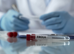 Ebola-epidemia Kongon demokraattisessa tasavallassa tappaa 65 ihmist&auml; ja 246 tapausta on raportoitu